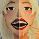 smiling woman comparing invisalign and braces