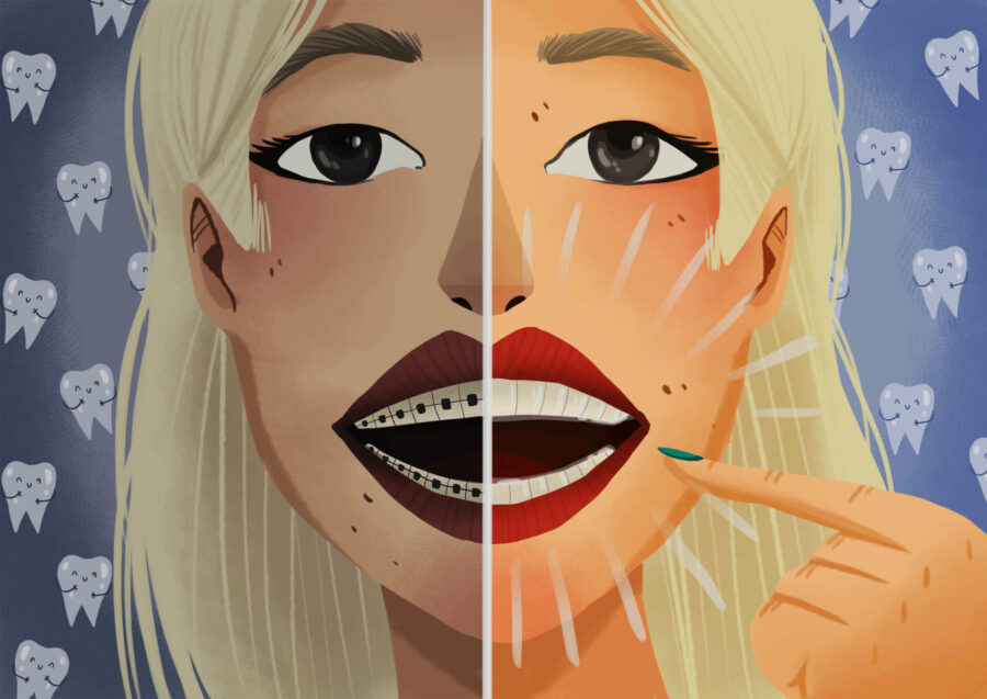 smiling woman comparing invisalign and braces